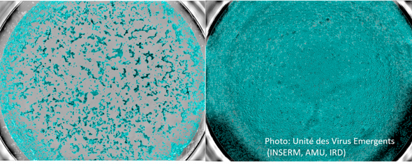 Séroneutralisation: cellules infectées (gauche) ou non (droite)